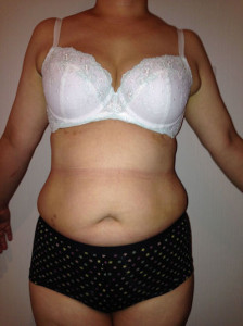 お客様の声　前面写真